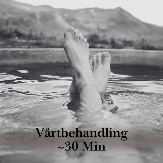 Vårtbehandling ~30 Min | Professionell Medicinsk Fotvård